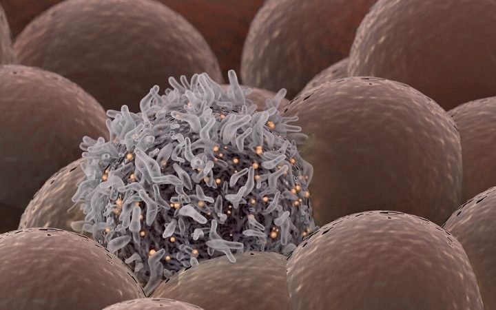 Technology that determines success of CAR-T cell immunotherapy could advance treatment of lymphomas